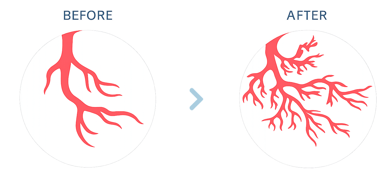 線形衝撃波療法