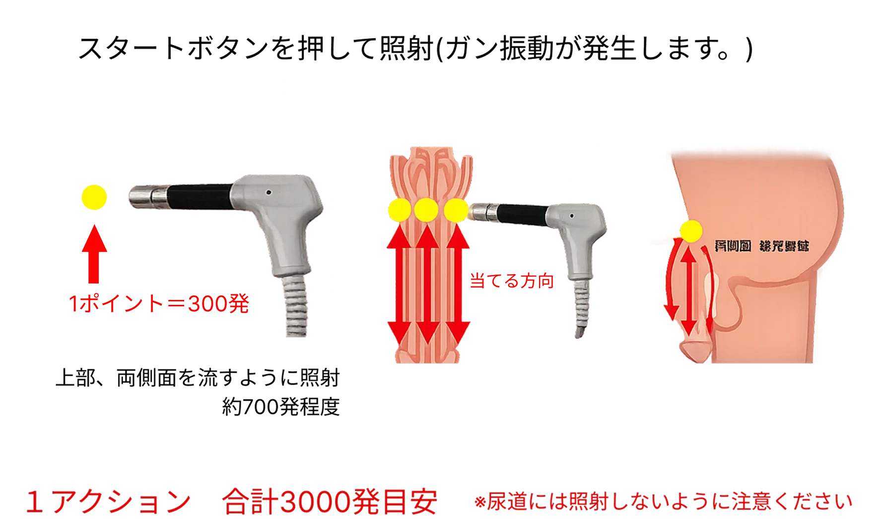 照射方法・場所（PC）