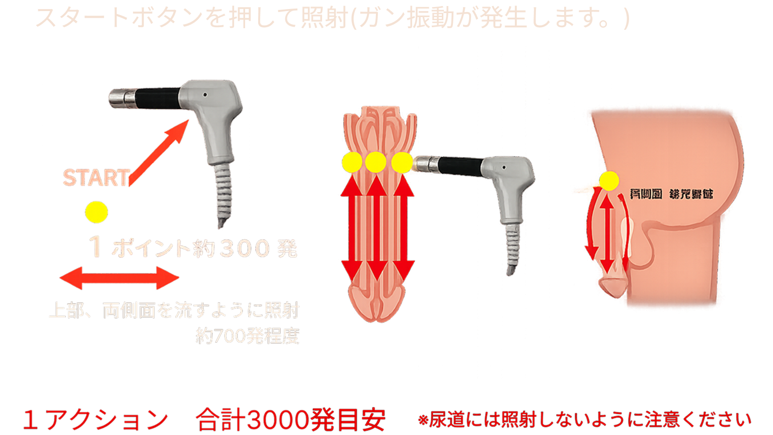照射方法・場所